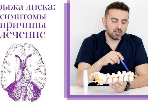 Особенности возникновения и лечения парамедианной грыжи