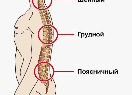 Какова вероятность, что с остеохондрозом возьмут на службу в армию