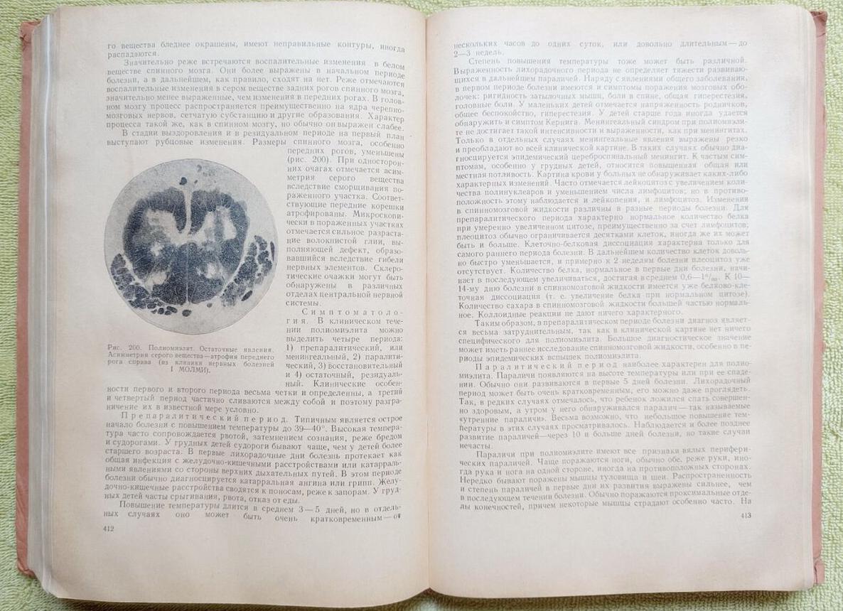 Начало развития остеохондроза: 1 степень патологии