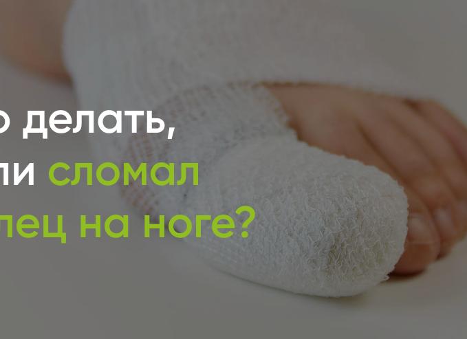Особенности лечения перелома мизинца на ноге