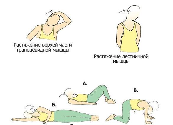 Правила выполнения лучших упражнений при остеохондрозе шейно-грудного отдела позвоночника