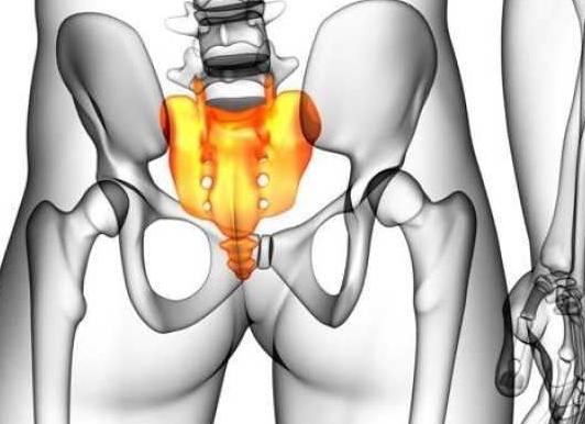 Причины копчиковой грыжи и методы ее устранения