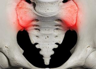 Симптомы, особенности лечения и прогноз сакроилеита