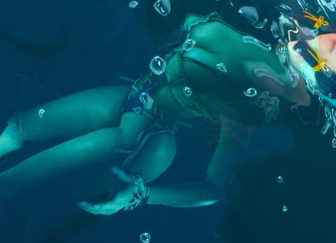 Полезные советы о том, как научиться ходить на костылях при переломе ноги